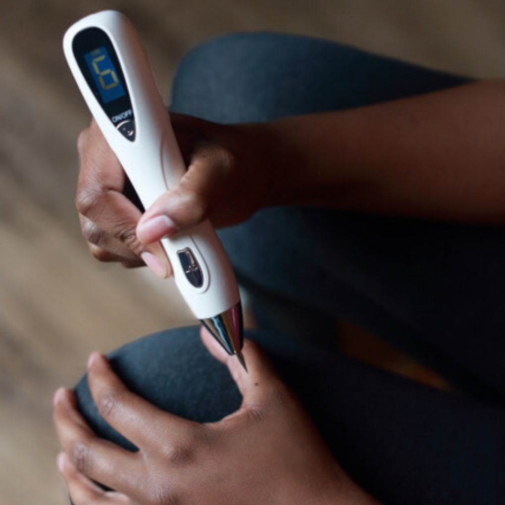 Skin Tag Tattoo Wart Mole Remover Beauty Tool 6 Power Levels USB Charger